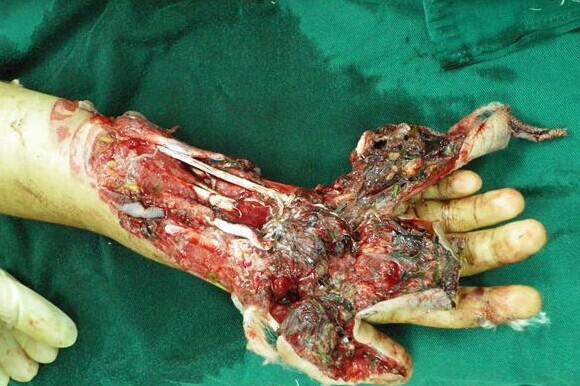 ����Ѫ��ģ�����֣����ǲҲ��̶á�