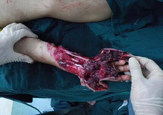 ����Ѫ��ģ�����֣����ǲҲ��̶á�