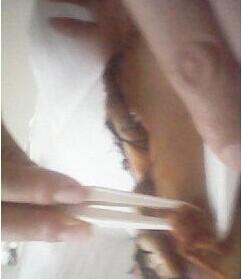 �������С�ĵĸ����ӻ�ҩ����������ʹ���̣���������ҧ��ë�����޺������Ǻܴ�