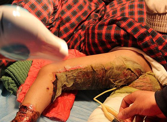 Со������ҩ��������ʹ����ֻ�����Ŵ����������ϣ��������㡣