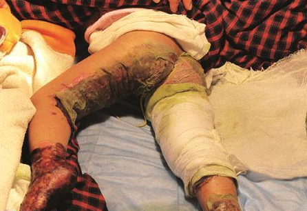 Со�������˵�ʱ��������޷����������ܵ�ʹ�ࡣ