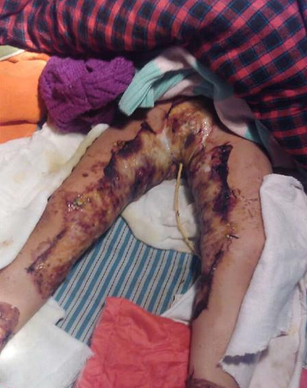 Со�������˺��ڼ�����������ҽԺ����Ƭ