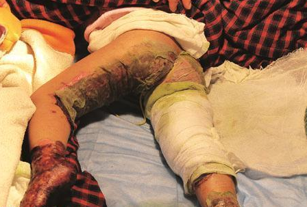 Со�������˵�ʱ��������޷����������ܵ�ʹ�ࡣ