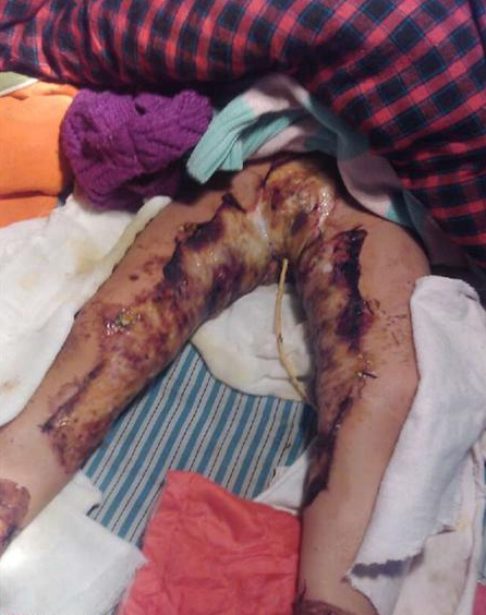 Со�������˺��ڼ�����������ҽԺ�ɼ�����Ƭ��