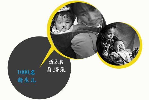 �ڽ�����й���ƽ��ÿ1000���������У����н�2�������Ѷ�ͯ������Щ�����У�Լ60%������ҽ���������ӵ�ũ�塣