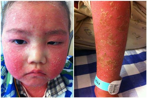 ȫ��������ɫ���ӣ���Ϊ�����С��ʱ��һ�����Ͻ�����ȥ����������ҽԺ��