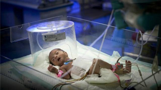 ��Щ��ǰ��������ı����ǣ���������������еļ�ͥ����������������������һ���˫��̥������������̥��ͬ�������������������ţ�ÿһ������Ҫ��ϸ����ĵĺǻ������ϣ�������ͥ�޷���������ݾ�ϸʱ�����ǽ���������û��