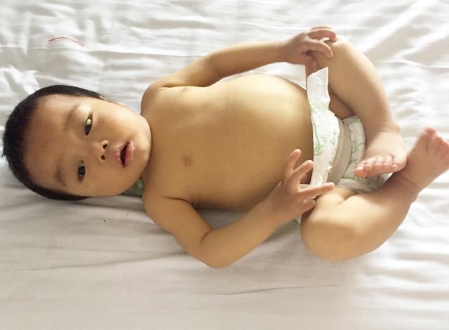 Ϊ���������ƣ������Ĵ���Ǯ��ҽ��˵С��ɭ���ĵ���������Ψһ����������ֻ��������ֲ��������δ�߳��������ص�һ���ˣ������ֲ������Ʒ��������ˣ� &ldquo;����ֲ&rdquo;����������˵��һ��İ�������µ����ۣ����ǵ�ҽ��˵��ĸ���Ծ�θ����ӵ�ʱ�򣬺�ɭ�����������ԥ�ؾ��������Ӿ�Ρ�