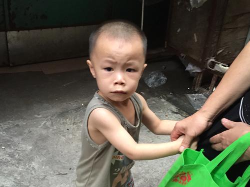 �Խ��Ǽ���ĳ��ӣ����ĵ�������������ͥ�Ļ���ֻ�������ĸ��¡��Խ�4���´��ʱ����ɫ������ף���ʼ����û������ʲô���⡣ֱ����һ����ղ���ȥҽԺ���ŷ������������͵��к�ƶѪ������һ��������Ǯ�Ĳ����Դˣ�һ��ũ���ͥ��ʼ����������ҽ·��