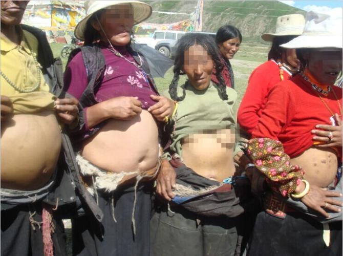 ������Ҫ��ʲô��&ldquo;ϣ��&middot;��������&rdquo;ּ��Ϊ���а��没��ƶ����Ů����ͯ�ṩ·�ѡ�ʳ�޷ѺͲ���ҽҩ�ѡ��ƻ�����67��������Ů��ͯ��ÿ�˴β���Ϊ2700Ԫ����·��ʳ�޷�1500Ԫ��ҽҩ��1200Ԫ������18��Ԫ����������Ļ����߳�ʯ���أ�����Ѱ����ҽ��