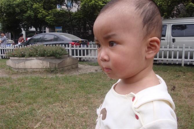 经受病痛折磨的她小小年纪就邹起了眉头