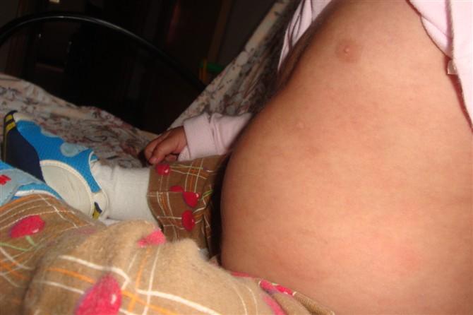 生病后肚子出奇的大