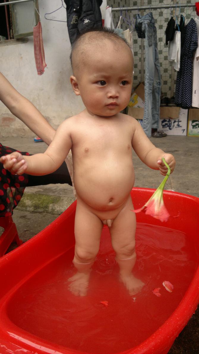 长期输血,小承轩的肚子已经很开始变大