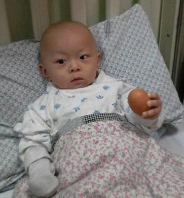 这张是孩子在北京儿童医院拍的,手术后第三天