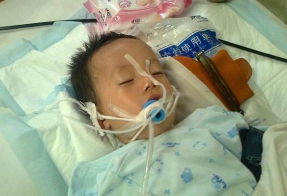 孩子从口腔插了呼吸管,这样子太可怜