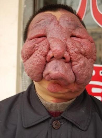 ǰǿ沿