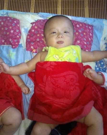 妹妹毕瑞希,出生时候2.6斤,脑发育迟缓,需要马上住院治疗