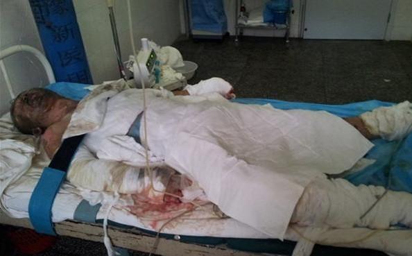 冯建广刚刚住院被绑到床上的情景