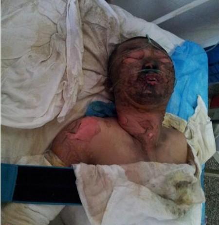 刚刚入院时候痛苦的翻动着,医生为了治疗,只能无奈的将他绑到了病床上