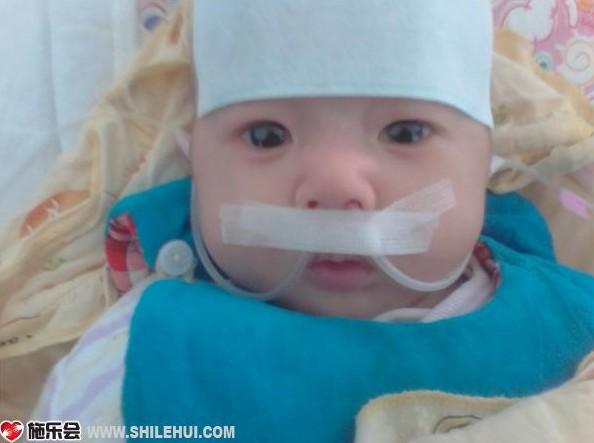 四个月的疾病摧残,坚强的小逸飞大眼睛依然明亮有神