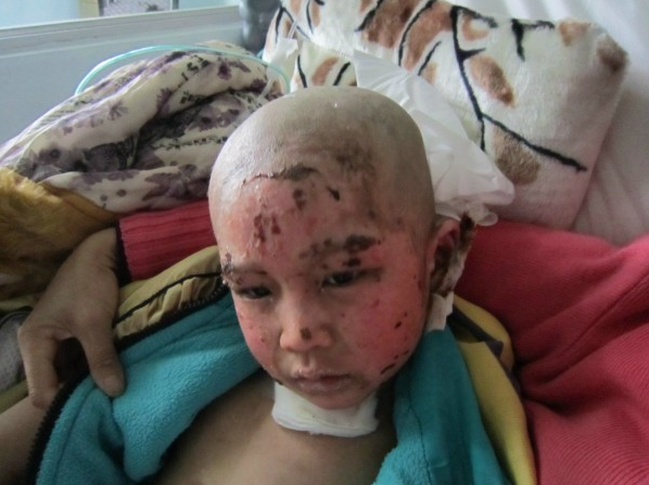 可怜的孩子,你承担了太多的痛!