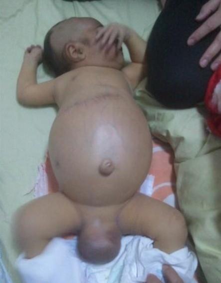 宝宝每天晚上都不睡觉,又说不出来哪里疼!做父母的好心疼