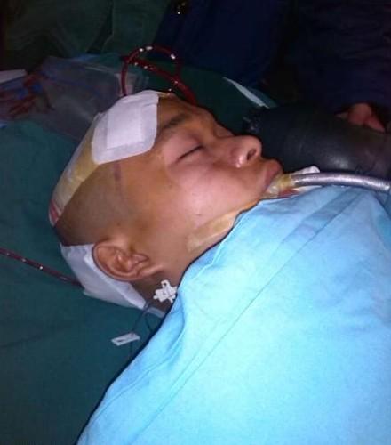 这是第一次开颅手术后出手术室