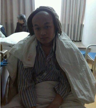 这是他手术前同学给他照的