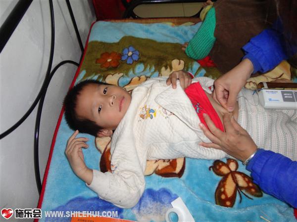 又到打上去铁胺的时候了,今年以来每次下针的那刻,孩子都很紧张,紧闭双眼,每次都在下针前跟他讲话,引开的注意力,很快下针,但每次一捏起肉他都能感到疼痛到来