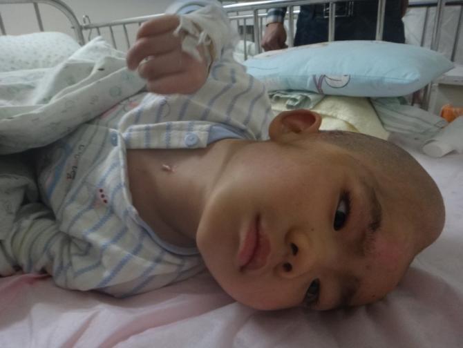 车祸后的小政,脑部明显严重变形,孩子每天都在承受着痛苦。