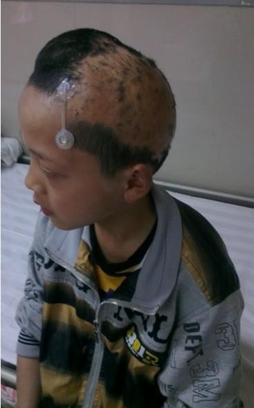 袁开合侧面图片