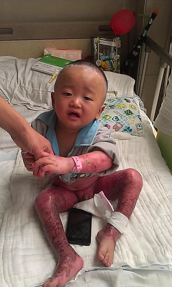 小腿和小胳膊让人触目惊心