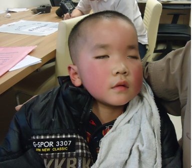 这时的小成朋已经失明,每个人的一次救助就可以让他重见光明。