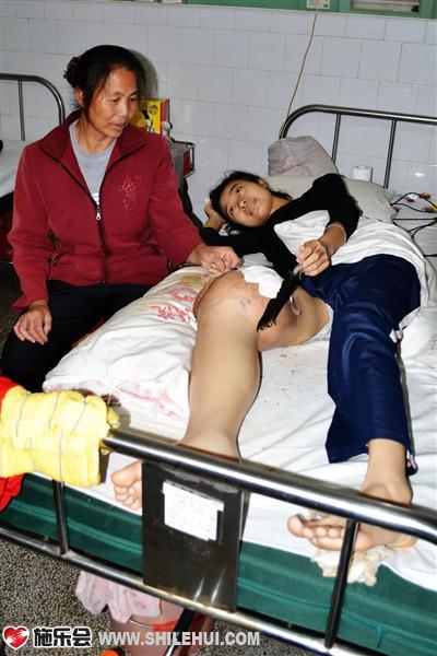 5月8日,养母谭章虾在床前陪护,右腿已经肿胀非常厉害,但是她依旧微笑面对