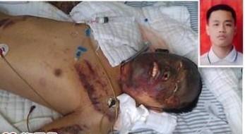 孩子伤前伤后判若两人