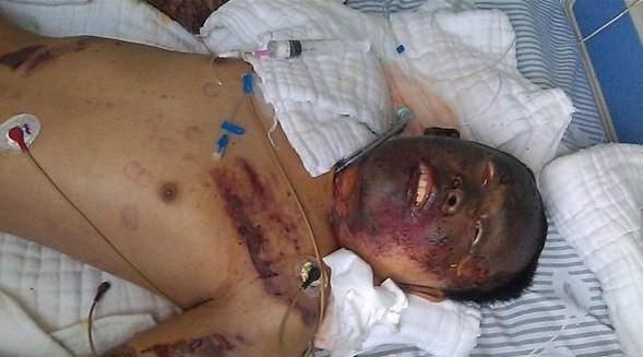 孩子意识清醒,不能说话,他只能睁开眼睛看着爸爸妈妈,不时表现出很痛苦的表情