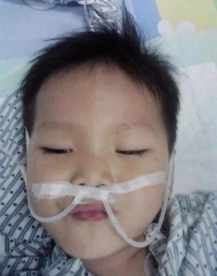 3月20日在雷州抢救后,小永豪转送到湛江中心医院三天后做检查时拍的,这时的小孩虽然和以前没有多大变化,但是不会吃东西,不会说话,眼睛只是睁开一点点,不认得人