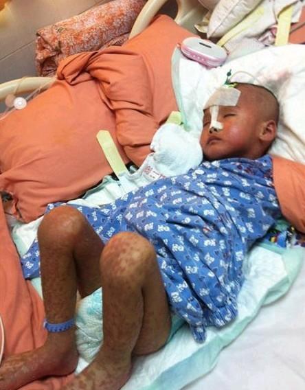 6月2日小永豪父母进入中山大学孙逸仙纪念医院PICU病房探望小孩时拍的,小永豪一直以来反复发烧、拉肚子和起皮疹最严重的一次,小孩全身都起皮疹,还连续几天高烧不退(39度多)