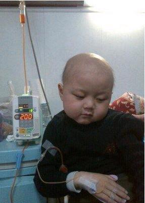 每次上化疗就要双手打针一天又一天啊。家人轮流的看护,时时刻刻担心这孩子