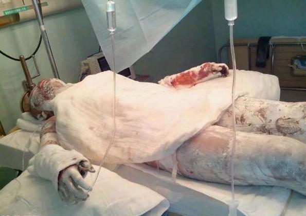 蒋佳秀的母亲,从来没见过好好休息一天,一直在为这个家庭打拼,从来没有放弃过。总是盼望孩子能有更好的生活。现在病榻上,她母亲伤的很重