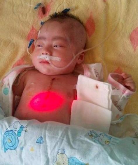 孩子手术后出监护室照的,纱布上还渗得有血,看起想哭