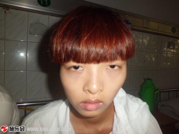 陈爱云是名弃婴,小时身体一直不好,检查才知患有先天心,因养你家境贫寒,无力给她手术,如今她的病情严重,急盼援助