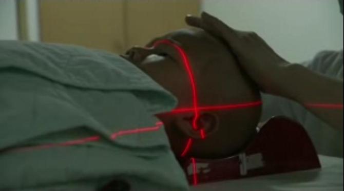 孩子治疗时照片