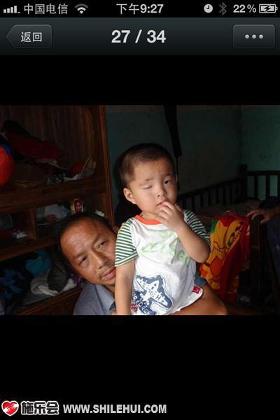 王宇泽的双胞胎哥哥,出生后右眼失明,脑瘫