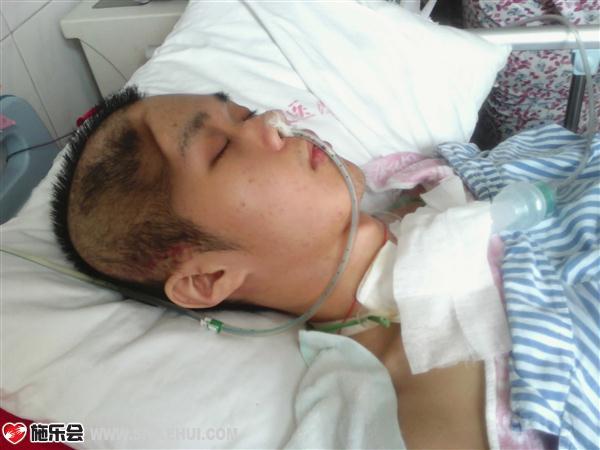 这是陈旭右脑半边凹陷,颈部插管化痰的照片。