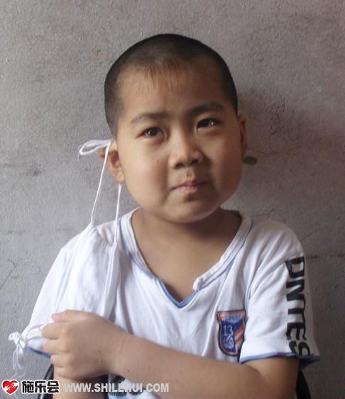 孩子不知道病情的严重性,还是笑的很天真