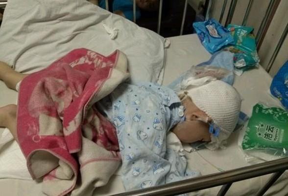 这可不是帽子哦,这是术后保护头骨用的