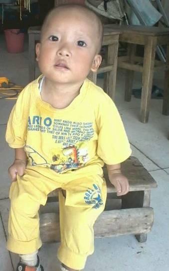 别人说小俊楠很可爱,,可是他身上有很多病,先天性心脏病、淋巴结核脓肿、发育迟缓、肺炎等