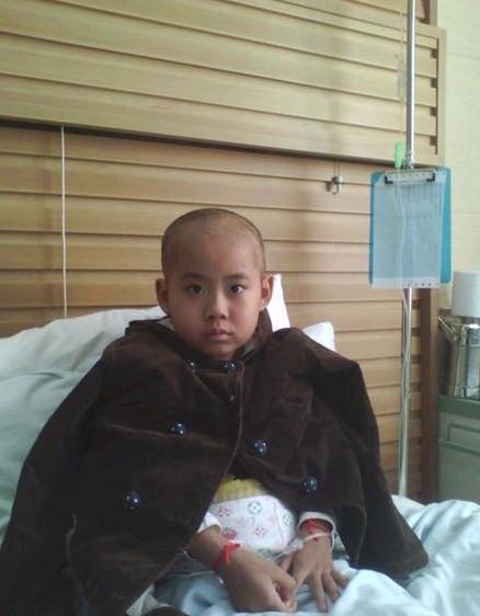 怡婷化疗后,头发稀稀疏疏的,干脆就剃掉了