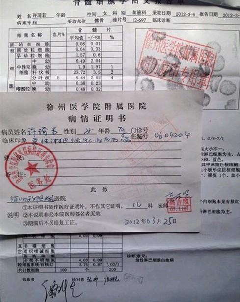 许琦若的检验报告,急性淋巴细胞白血病